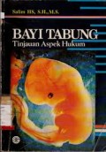 Bayi tabung : tinjauan aspek hukum